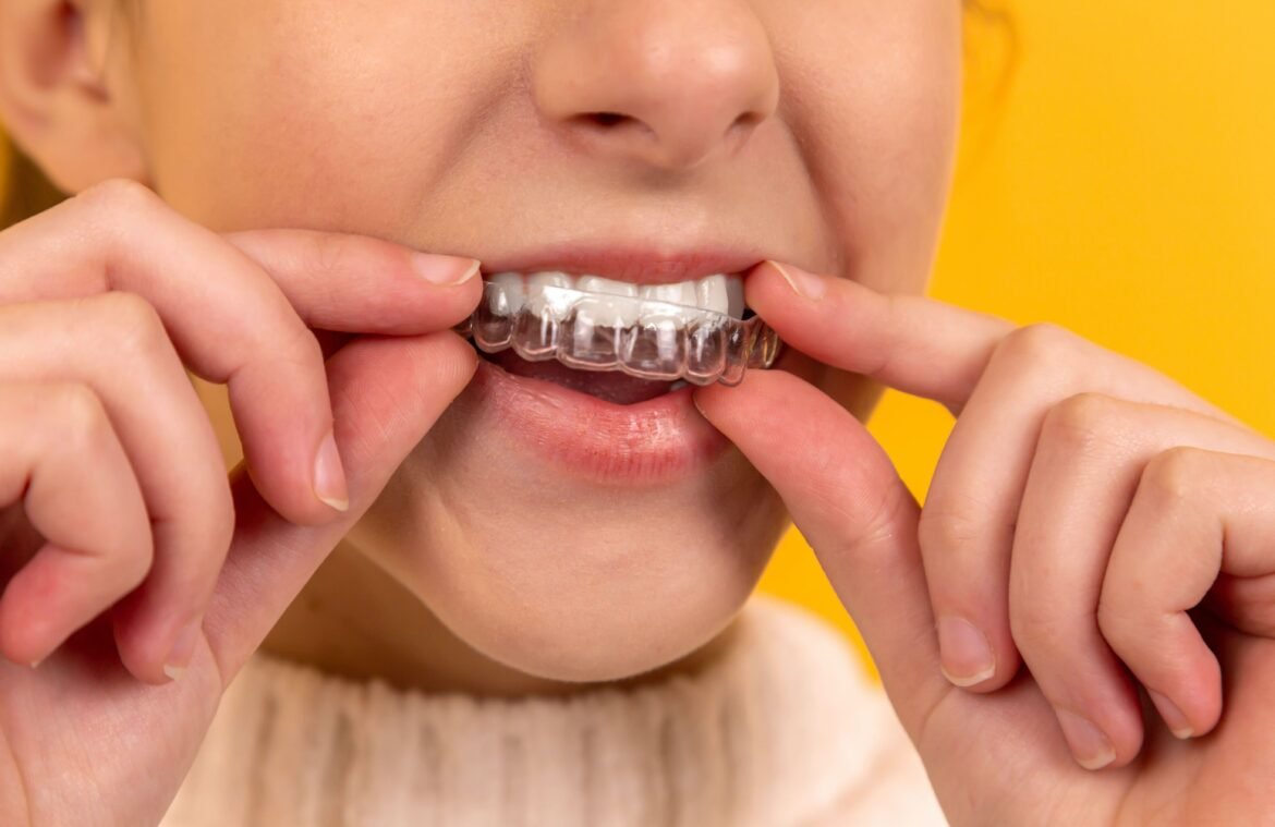 Orthodontie Invisible Sanary